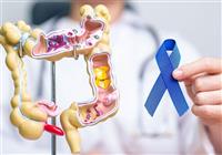  علائم ابتلا به سرطان روده بزرگ/ سن مناسب انجام کولونوسکوپی 